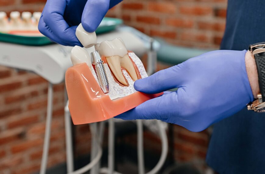 Dental implant and partial denture options for replacing missing teeth at A Plus Dentistry in Brookline, MA.