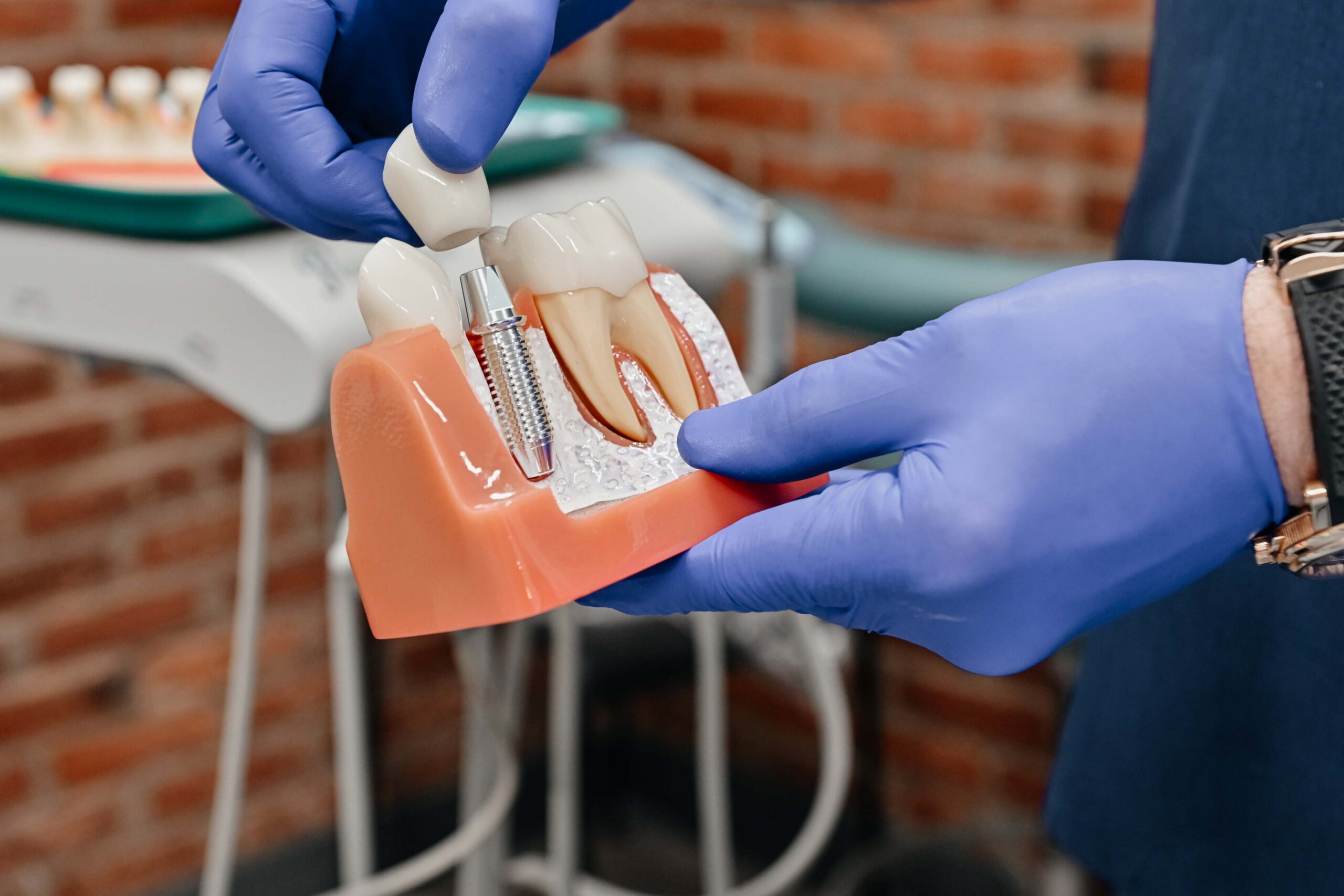 Dental implant and partial denture options for replacing missing teeth at A Plus Dentistry in Brookline, MA.